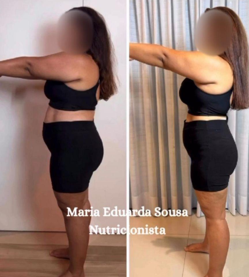 Resultado antes e depois 2
