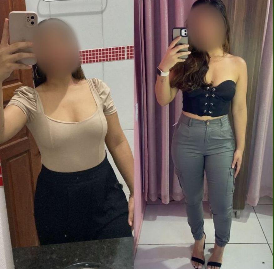 Resultado antes e depois 3