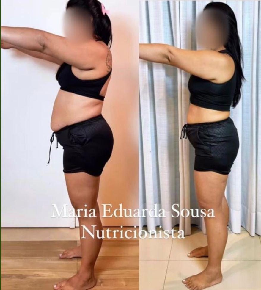 Resultado antes e depois 1